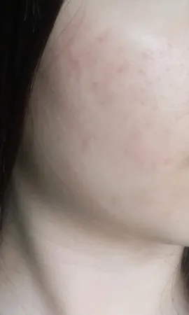 کرم روشن کننده راکوتن مدلLightening حجم 40 میلی لیتر