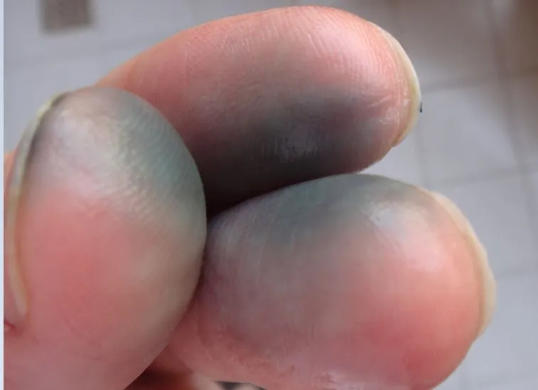 کپسول ویتامین ث با رزهیپ آلامو بسته 100 عددی