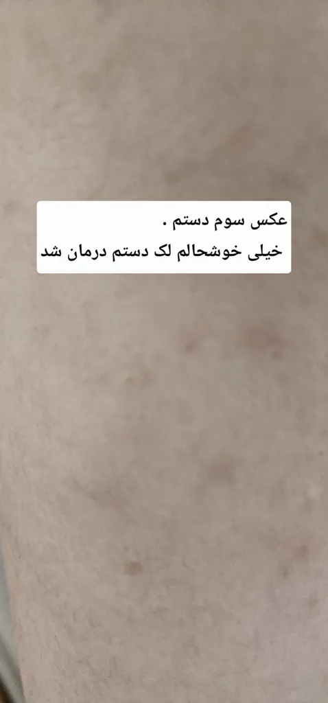 کرم ضد لک صورت دامیثا مدل Tekno123 مناسب برای انواع پوست حجم 30 میلی لیتر