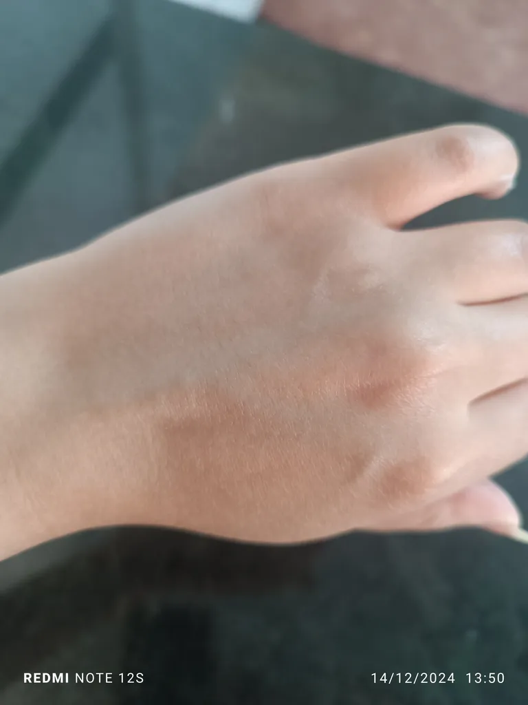 کرم مرطوب کننده سیوند مدل اوره و اوسرین 20 درصد حجم 150 میلی لیتر