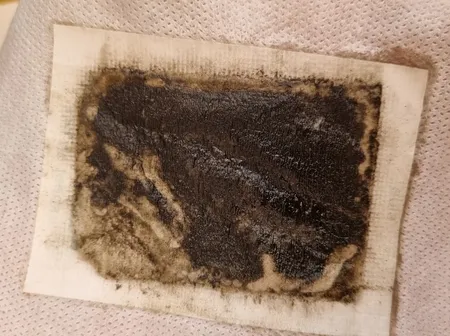 پد دفع سموم بدن کینوکی مدل mp-913 بسته 10 عددی