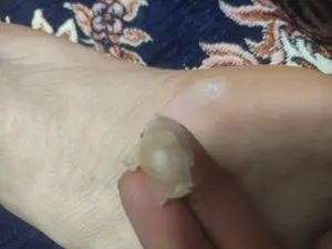 تجریه خرید چسب برطرف کننده میخچه پرودوفیکس مدل Corn Plasters بسته 6 عددی