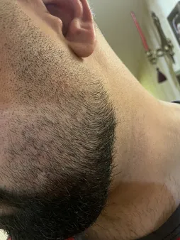 ماشین اصلاح موی سر و صورت شیائومی Grooming Kit Pro XMGHT2KITLF