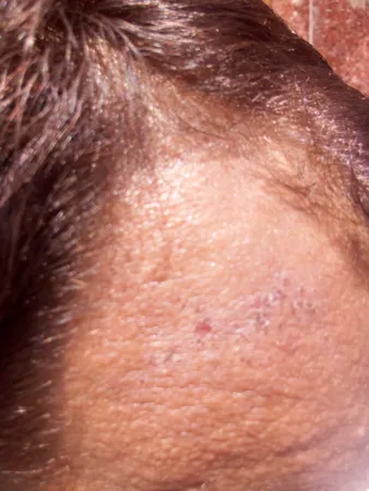 اسکراب لایه بردار پوست مکس لیدی مدل Coconut حجم 300 میلی لیتر