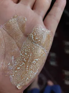 تجریه خرید کرم ضد آفتاب توتال درم مدل biotech02 حجم 50 میلی لیتر