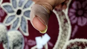 تجریه خرید چسب زخم کی ام کد 1873171 بسته 50 عددی