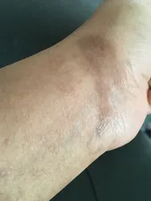 تجریه خرید کرم ضد لک فیس دوکس سری Pigmasome مدل Sulfora White حجم ۵۰ میلی لیتر