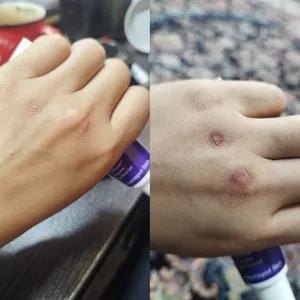 تجریه خرید کرم ترمیم کننده پوست صورت درمالیفت مدل سیکالیفت مناسب پوست‌های آسیب‌دیده حجم 30 میلی لیتر