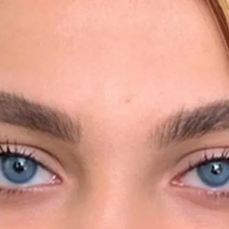 لنز چشم هرا مدل B رنگ آبی