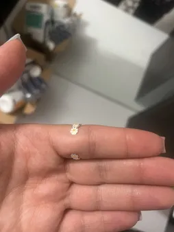 انگشتر زنانه برانت طرح گل بابونه