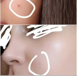 تجریه خرید کرم ضد جوش آردن بیوتی مدل روغن درخت چای حجم 50 میلی لیتر