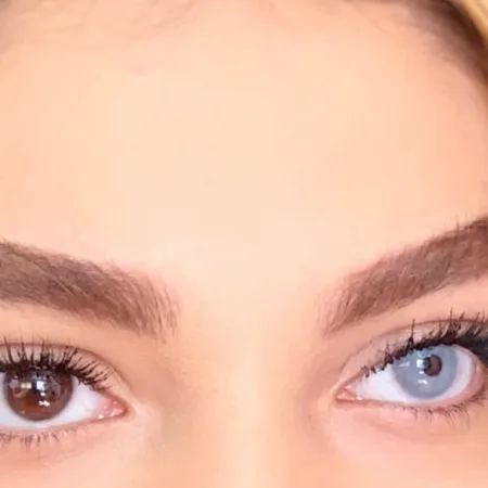 لنز چشم هرا مدل B رنگ آبی