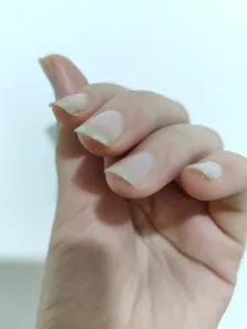 تجریه خرید محلول محرک رشد ناخن هیدرودرم کد 01 حجم 8 میلی لیتر