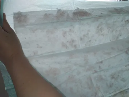 پد زیرانداز بهداشتی درماپد مدل آنتی باکتریال مجموعه 10 عددی