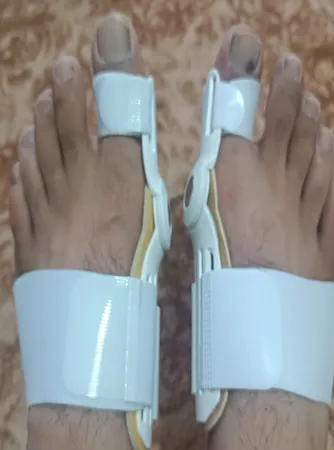 اسپیلنت اصلاح کننده شست پا مدل LSJ - 6