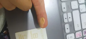 تجریه خرید کرم ضد جوش درمالوگ مدل BR حجم 30 میلی لیتر