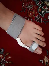 تجریه خرید اسپلنت هالوکس والگوس عظیم طب مدل v3