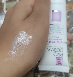 تجریه خرید کرم ضد لک پرودرما سری Spotvest مدل Radiance حجم 20 میلی لیتر