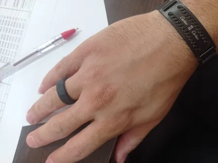 انگشتر کد 25