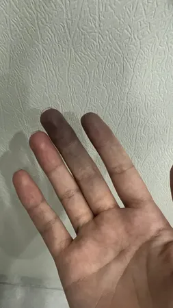 اسکراب لایه بردار پوست مکس لیدی مدل with ice حجم 300 میلی لیتر