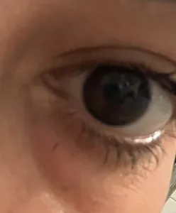 تجریه خرید سرم دور چشم سیلکر مدل 01 حجم 15 میلی لیتر