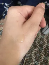 تجریه خرید سرم پوست درمالوگ مدل Hyaluronic Acid حجم 50 میلی لیتر