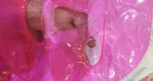 تجریه خرید آتروپات سرمایی ژله ای صورت