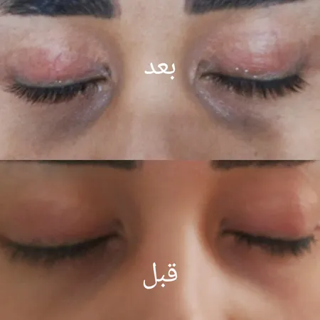 سرم تقویت کننده مژه آیسول مدل 01 حجم 4.2 میلی لیتر