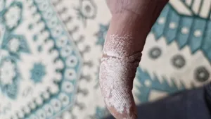 تجریه خرید محلول آب اکسیژنه آریا مدل هیدروژن پراکساید حجم 500 میلی لیتر