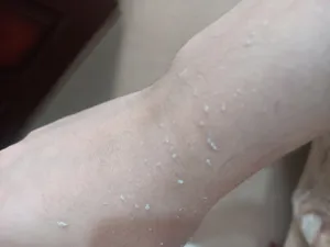 تجریه خرید اسکراب لایه بردار پوست ایمجز مدل Fruit Acid حجم 80 میلی لیتر