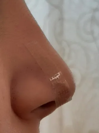 چسب لیفت بینی مدل 002