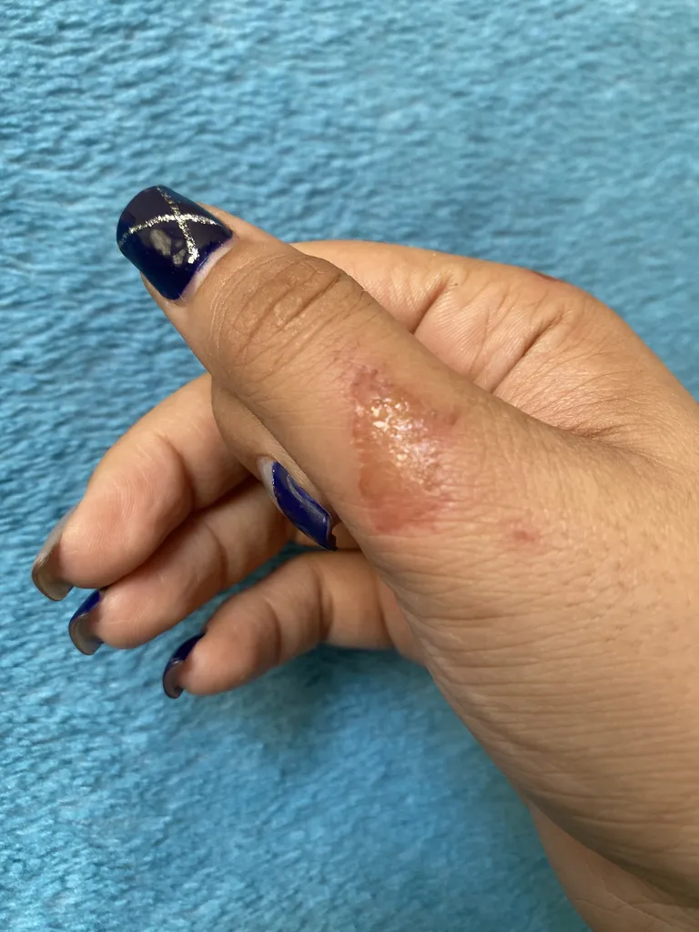 کرم ترمیم کننده سی گل مدل میموزا 10 درصد مناسب انواع پوست حجم 30 میلی لیتر