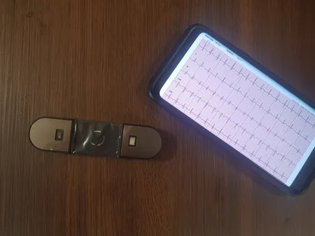 دستگاه ثبت نوار قلب نبض آوا مدل NH1- Handheld