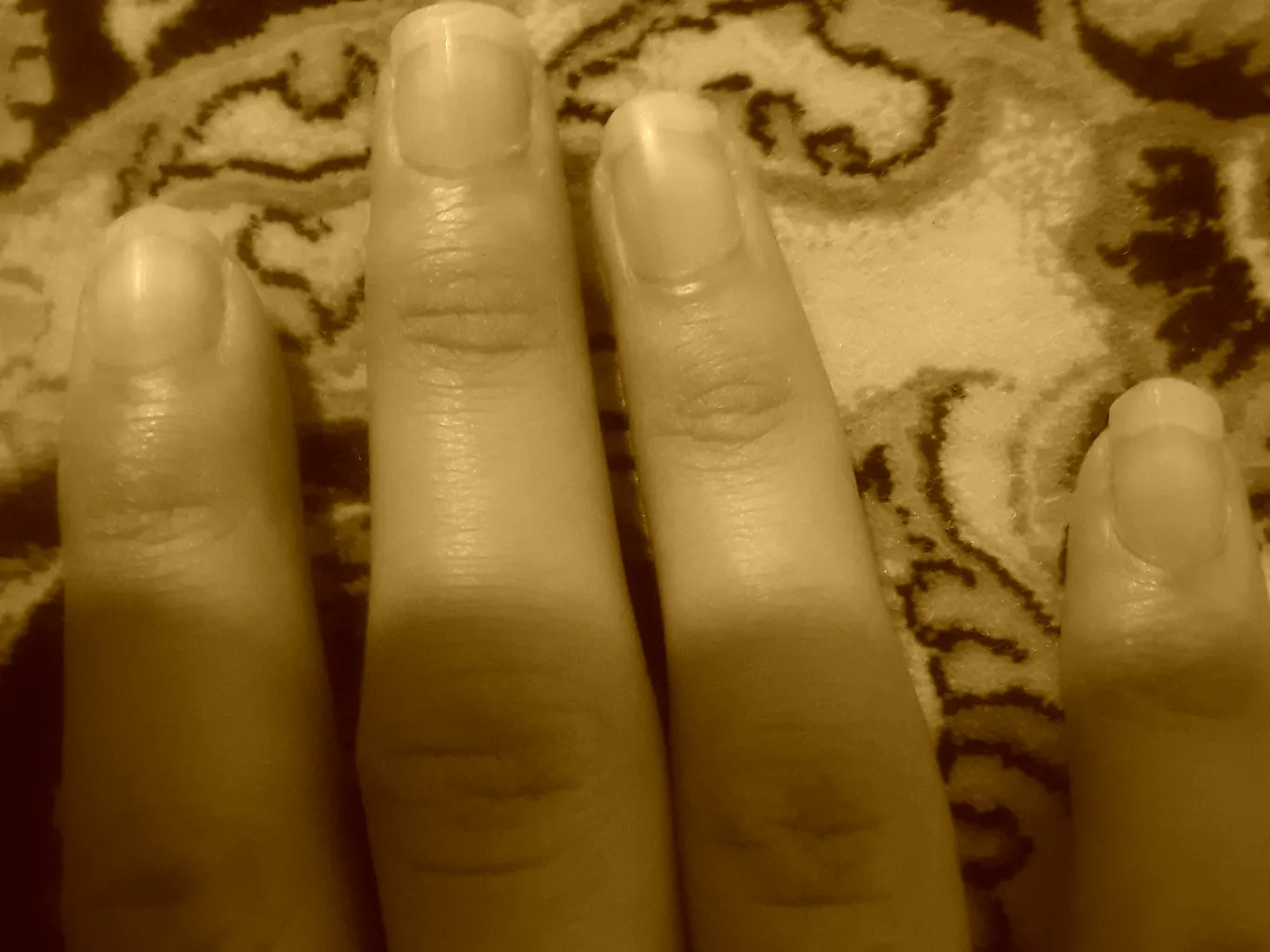 کرم تقویت کننده ناخن نئودرم سری Renewal مدل Intense حجم ۱۵ میلی لیتر