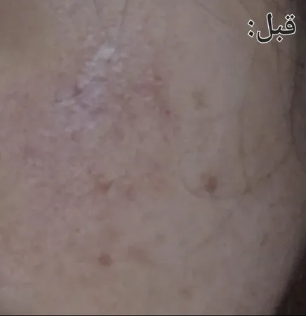 سرم ضد لک ویتالیر مدل آربوتین حجم 30 میلی لیتر