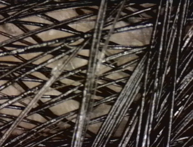 دستگاه آنالیز پوست و مو مدل inskam314