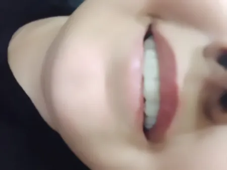 لمینت متحرک دندان اسنپ اسمایل کد 110