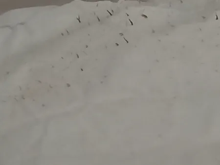 ماسک بینی لنبنا مدل سر سیاه مناسب انواع پوست وزن 30 گرم