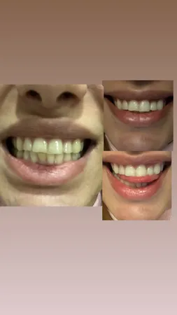 پودر سفید کننده دندان کازیوه مدل زغال فعال وزن 80 گرم