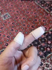 تجریه خرید چسب زخم مدیکس مدل Antiallergic بسته 100 عددی