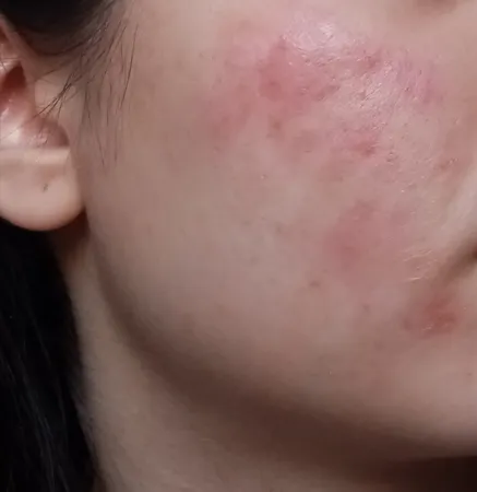 کرم روشن کننده راکوتن مدلLightening حجم 40 میلی لیتر