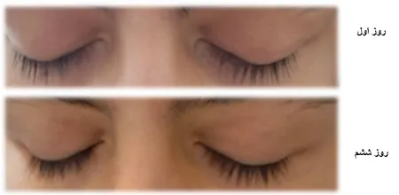 سرم تقویت کننده مژه پرایم مدل ultra