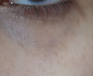 تجریه خرید کرم دور چشم رنگی پرودرما سری Eyevest مدل Anti Wrinkle Spf 30 حجم ۲۰ میلی لیتر