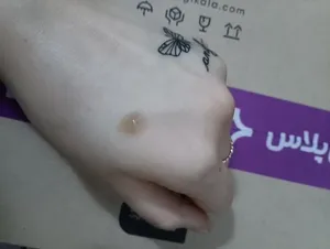 تجریه خرید سرم ضد جوش سیلکر مدل 01 حجم 15 میلی لیتر