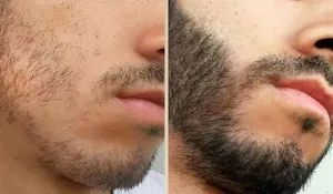 تجریه خرید روغن تقویت کننده ریش و سبیل گیاه قانون مدل 01 حجم 30 میلی لیتر