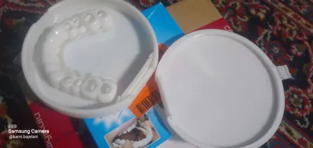 لمینت متحرک دندان اسنپ اسمایل کد 110