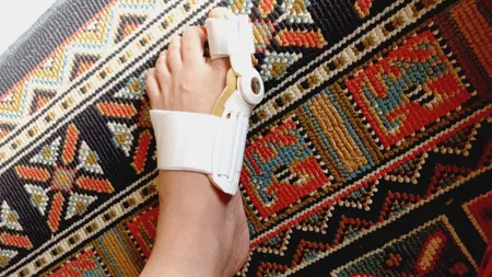 اسپیلنت اصلاح کننده شست پا مدل LSJ - 6