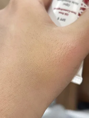 کرم پودر آکنه تیوبی مای مدل Acneline A02 حجم 35 میلی لیتر