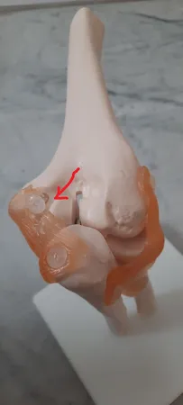 بازی آموزشی طرح مولاژ مفصل آرنج مدل XC-112