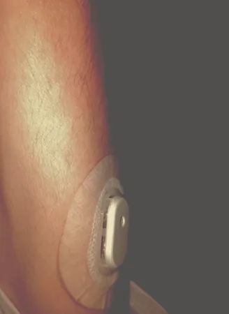 سنسور تست قند خون سایبایونیکس مدل GS1